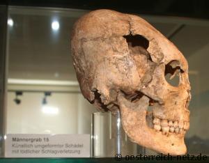 Schädel eines Ostgoten im Museum Globasnitz