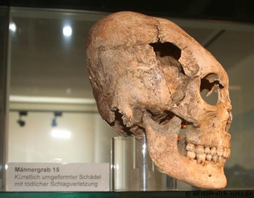 Schädel eines Ostgoten im Museum Globasnitz